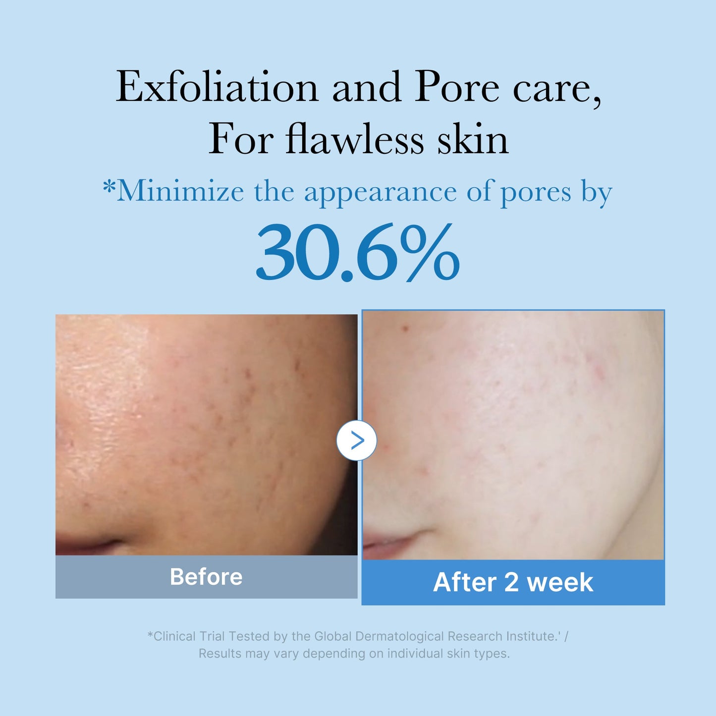 zero-pore-toner-y8 01_d6480b4e-3c08-4954-994a-ed5212c1839c.jpg