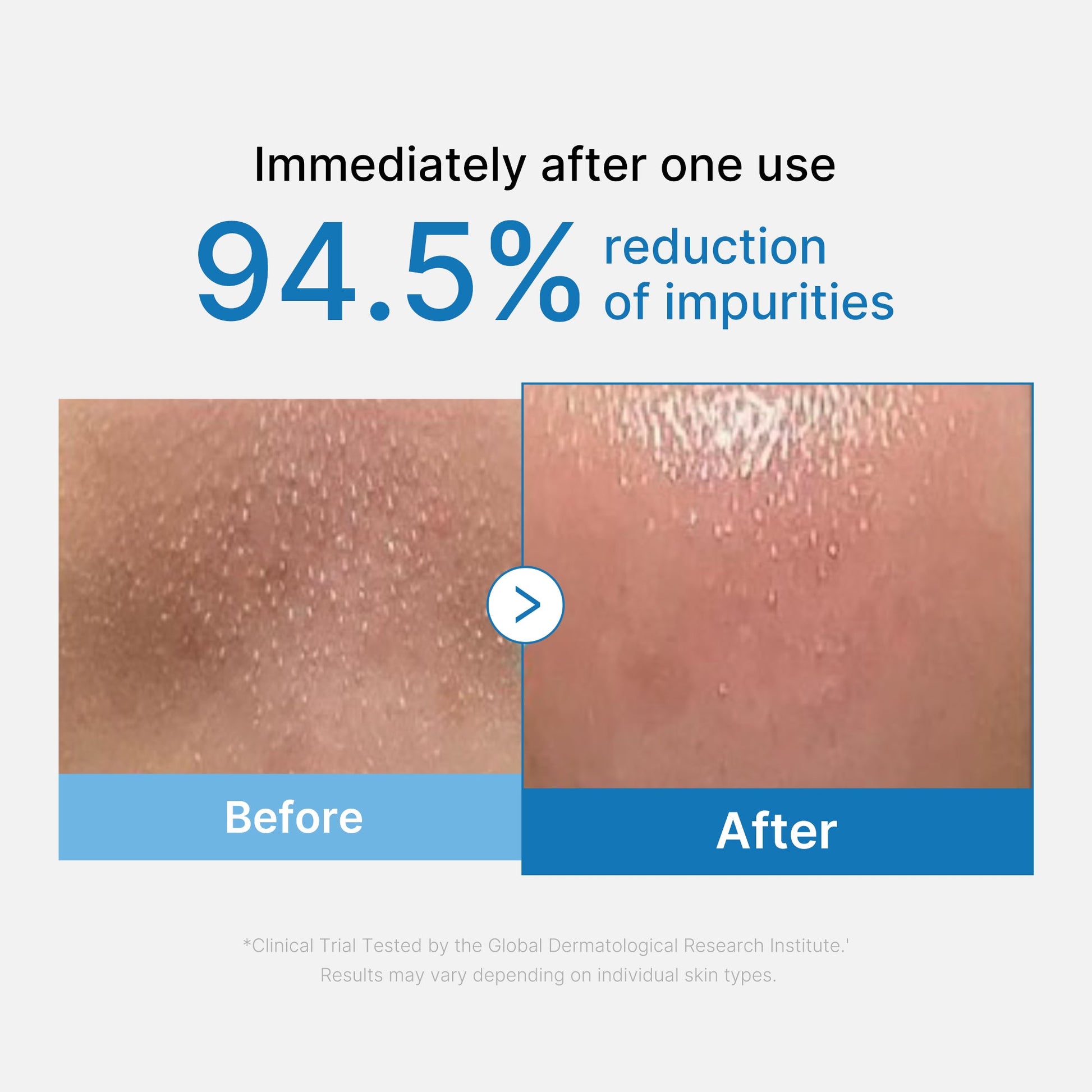 zero-pore-blackhead-deep-cleansing-oil-i4 01_eed557ec-5857-46a2-8b17-dbd67c692dcb.jpg
