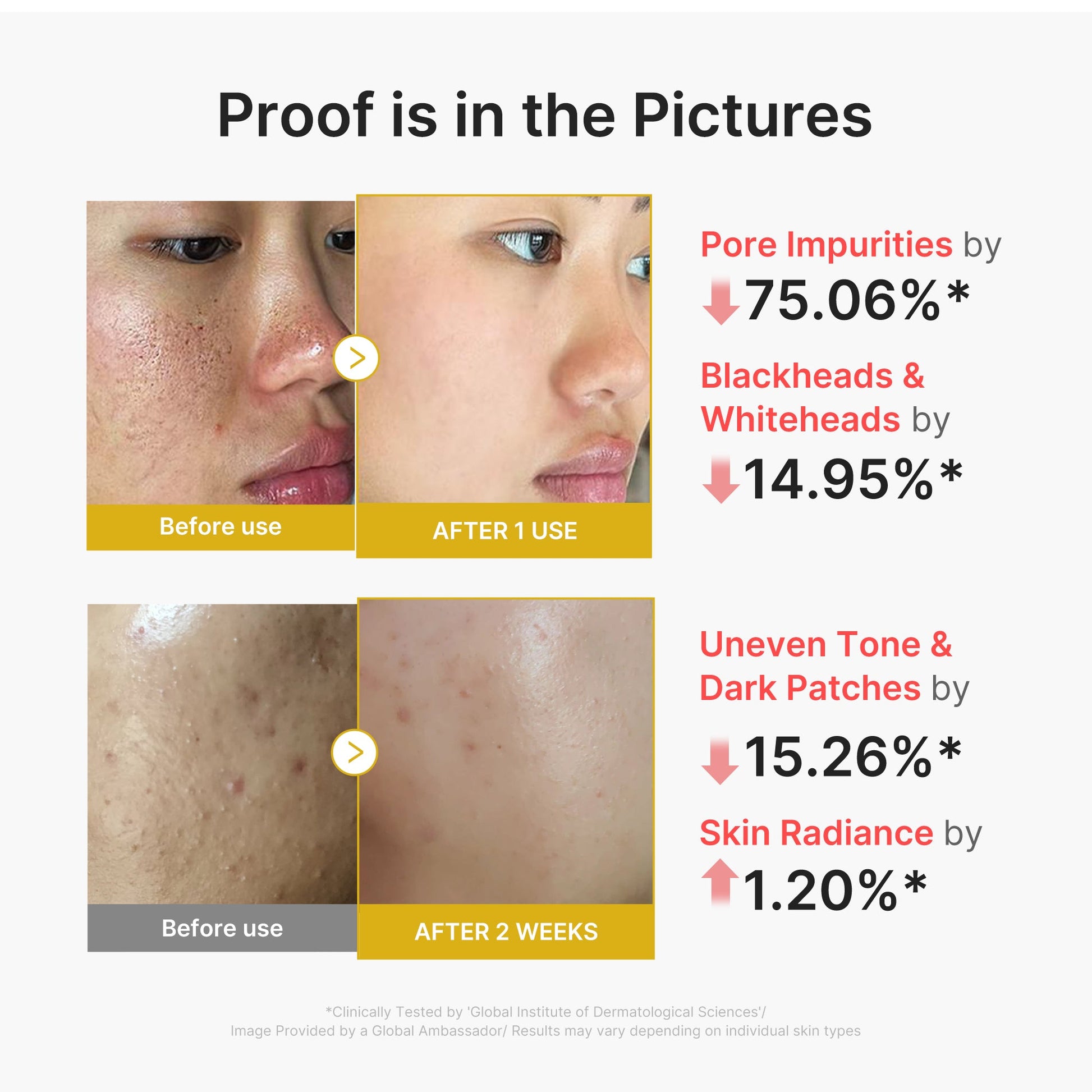 kojic-acid-turmeric-peel-shot-k7 02_45fe66d3-b3f6-4100-aa52-2afd7eded417.jpg