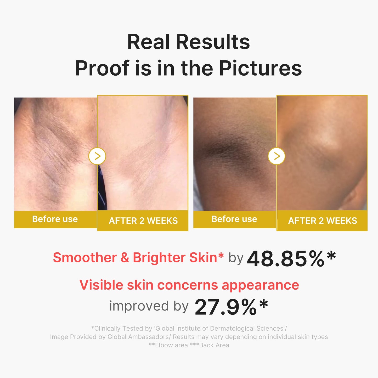 kojic-acid-turmeric-body-peel-shot-t9 02_72880cfc-382b-440b-8152-7e3dce87da2a.jpg