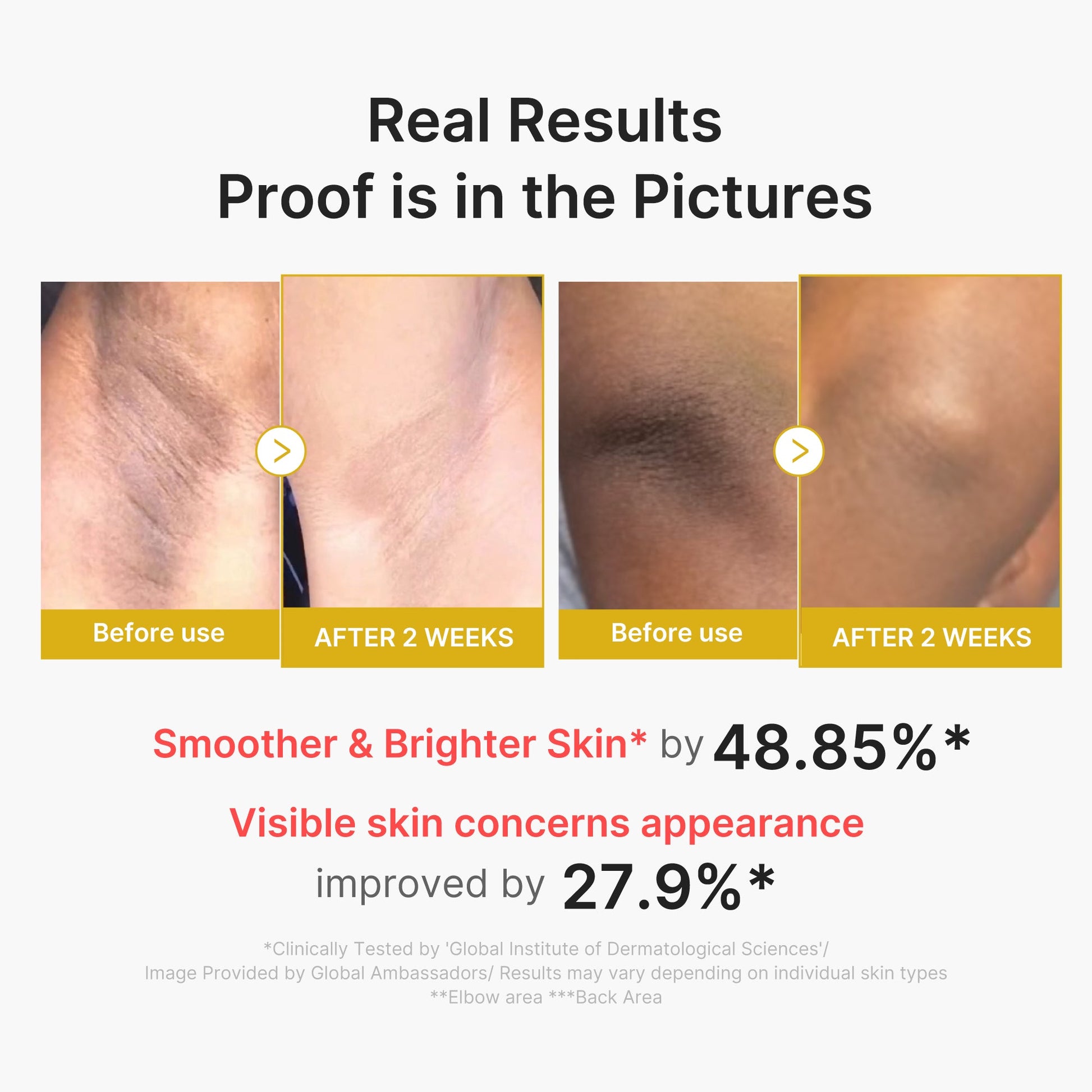kojic-acid-turmeric-body-peel-shot-t9 02_72880cfc-382b-440b-8152-7e3dce87da2a.jpg