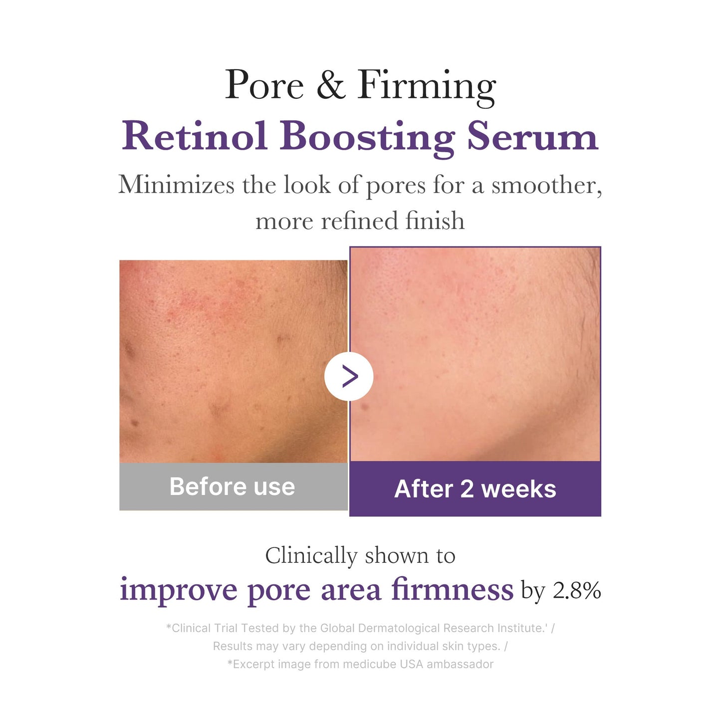 retinol-nmn-boosting-serum-w2 03_3510e7a5-5633-4a18-81ea-1389593bd517.jpg