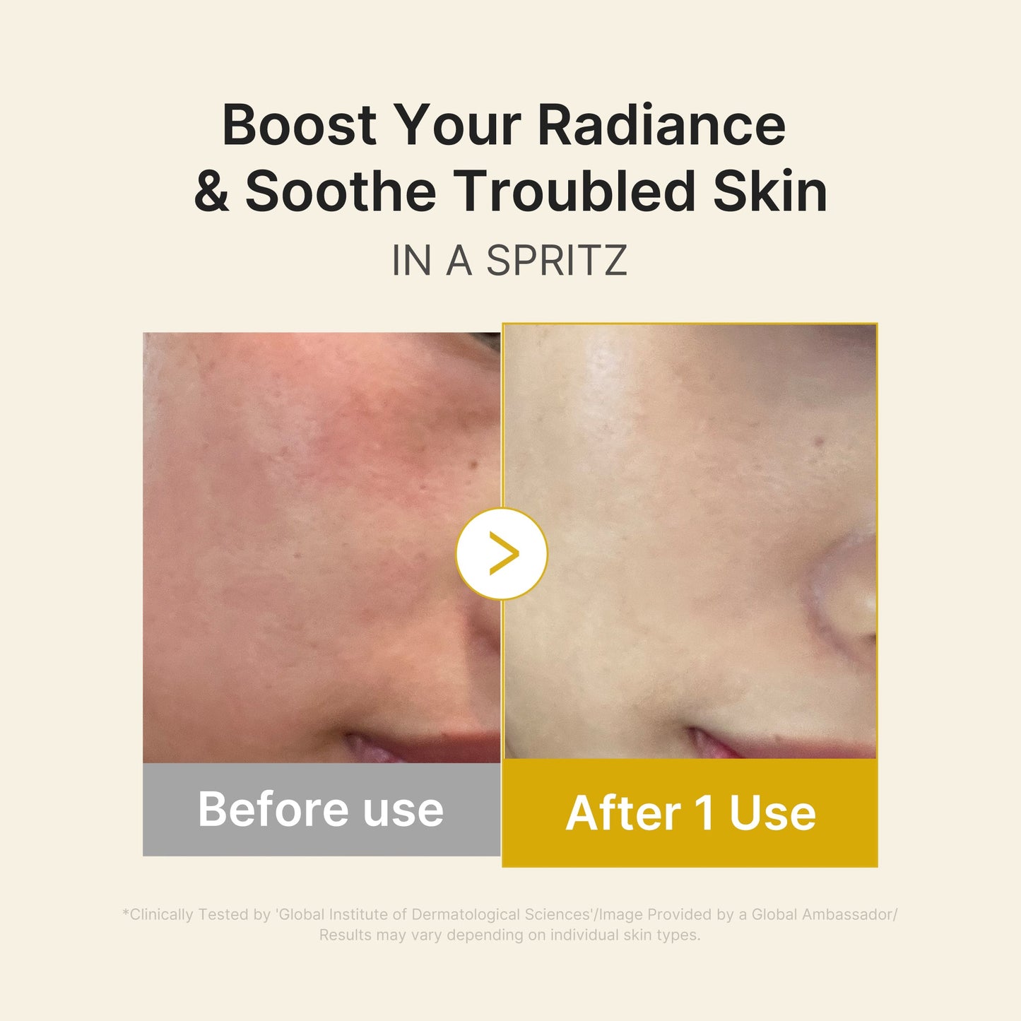 kojic-acid-turmeric-vitamin-gold-jelly-mist-serum-m9 03_dc9cd19e-4e57-49d3-9b66-c7762e8a63f1.jpg
