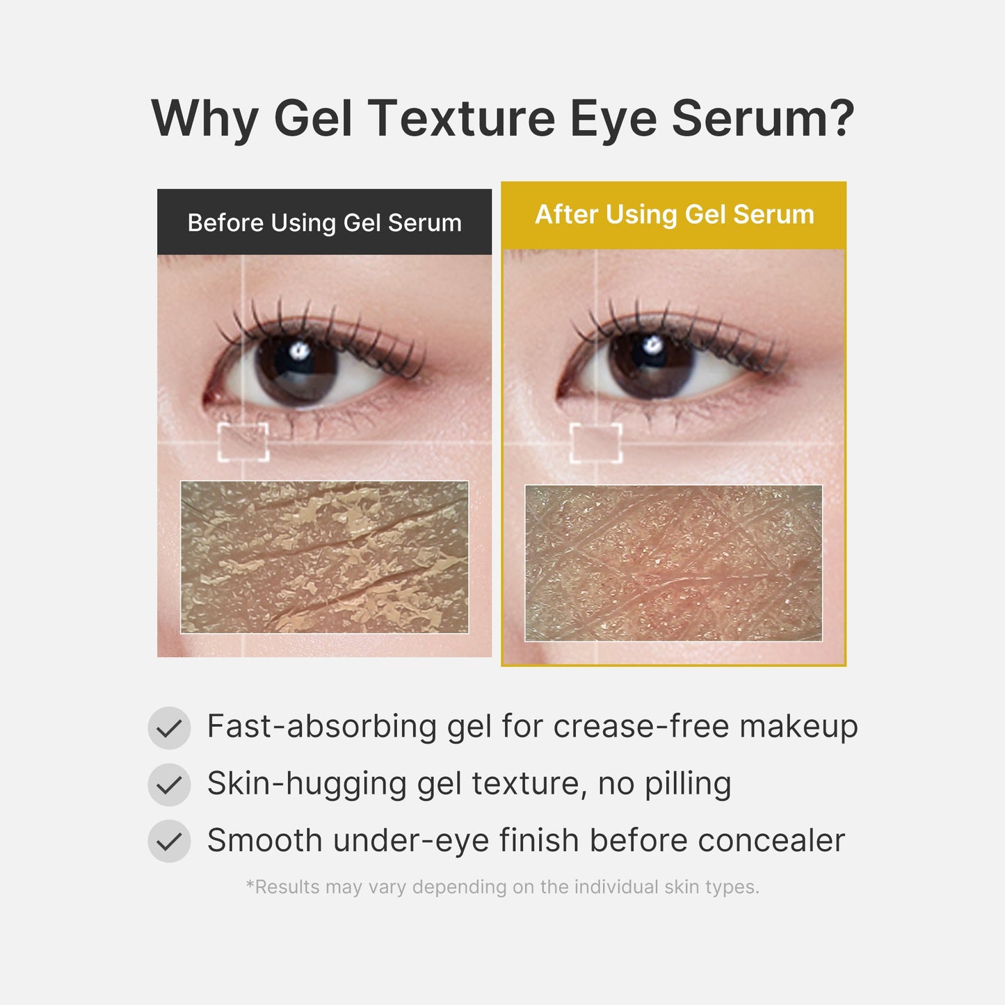 kojic-acid-tumeric-eye-gel-serum-u4 04_0487ef36-49f4-4294-8049-bb55118b05fe.jpg
