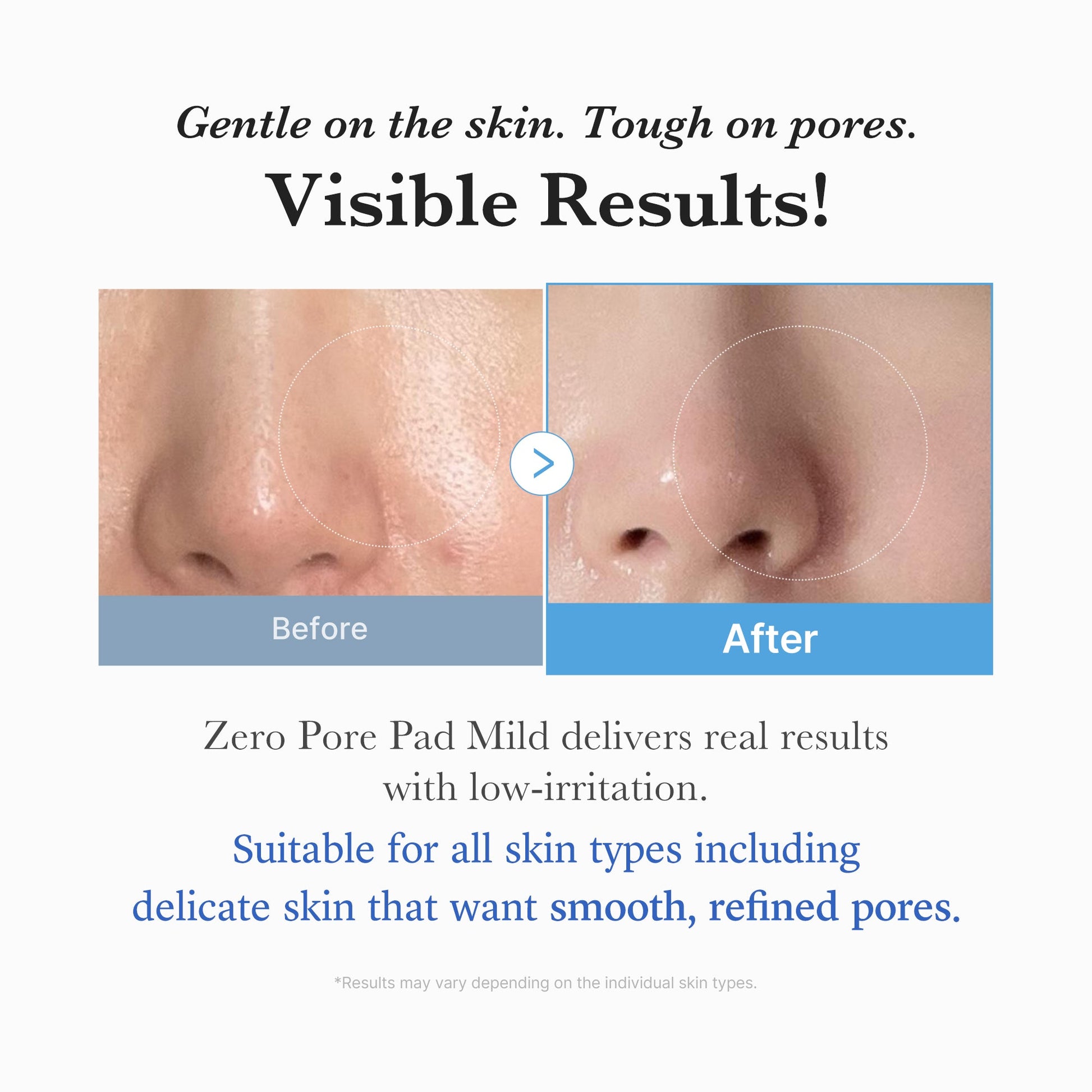 zero-pore-madecassoside-pads-mild-c6 04_6357f9f9-483b-4891-82c6-a58d336e62c8.jpg