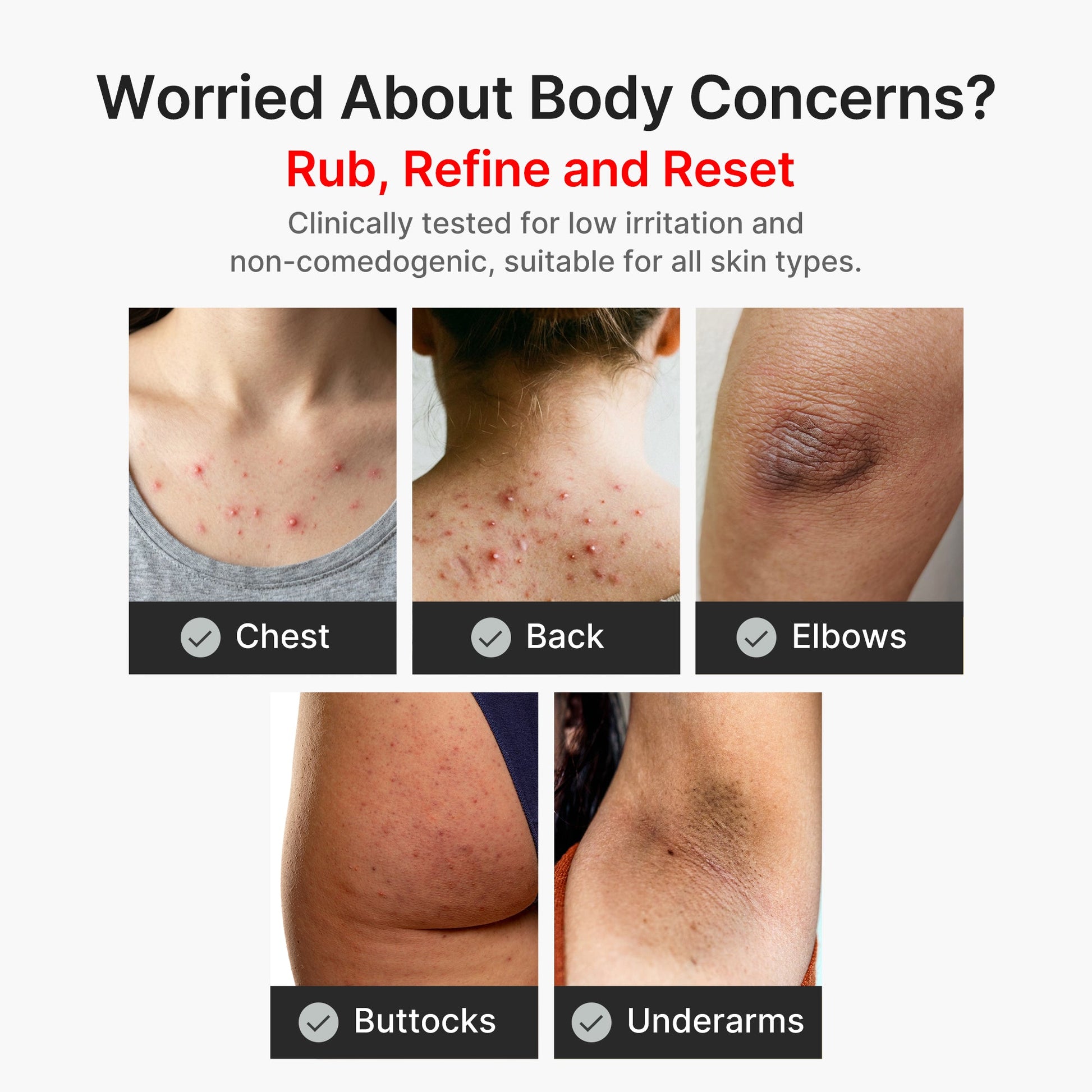 kojic-acid-turmeric-body-peel-shot-t9 04_8a7237f2-3ebf-401e-bd85-54841aeb3efc.jpg