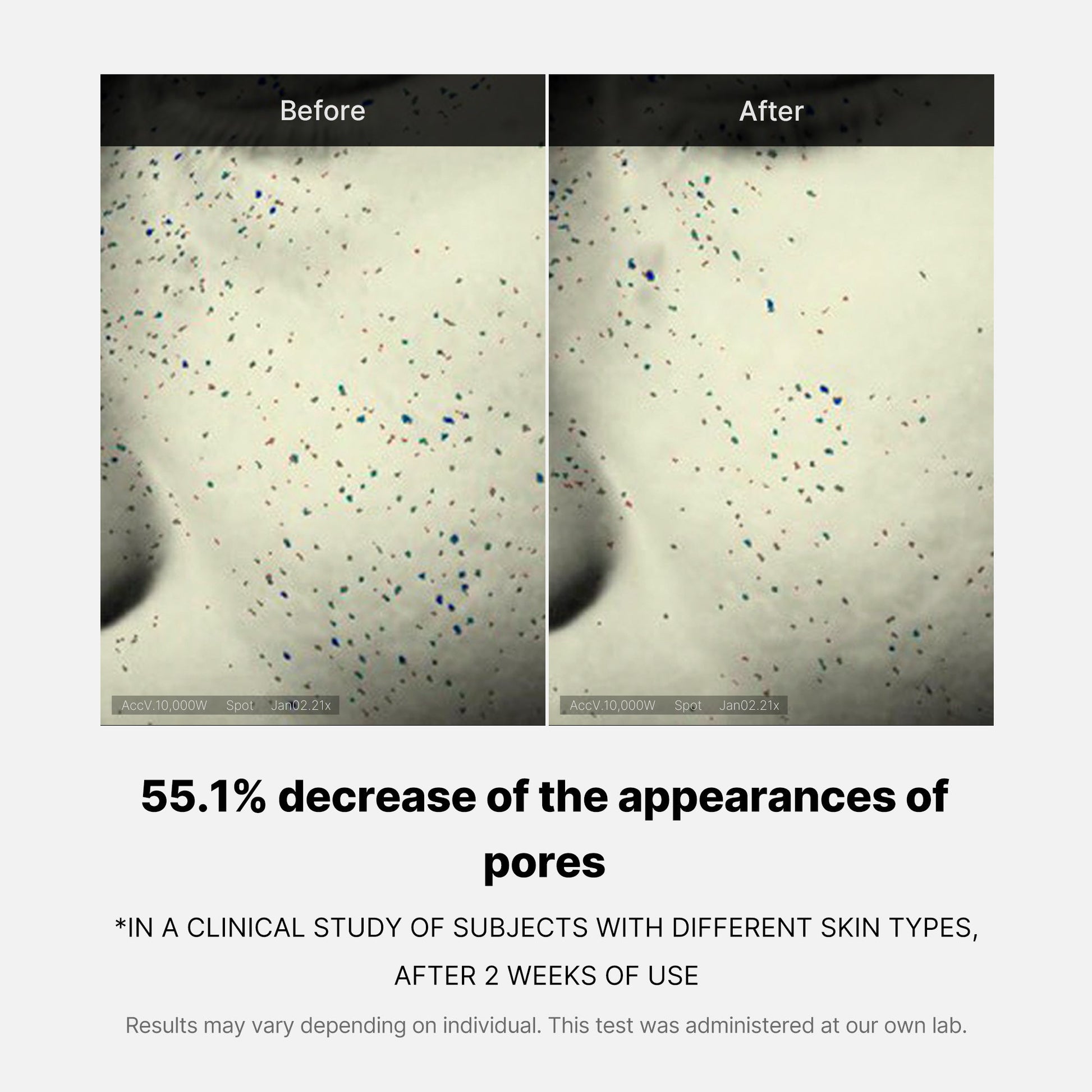 pore-care-duo-m8 05_12ddab8a-64be-4612-8ee1-27e5ec701921.jpg