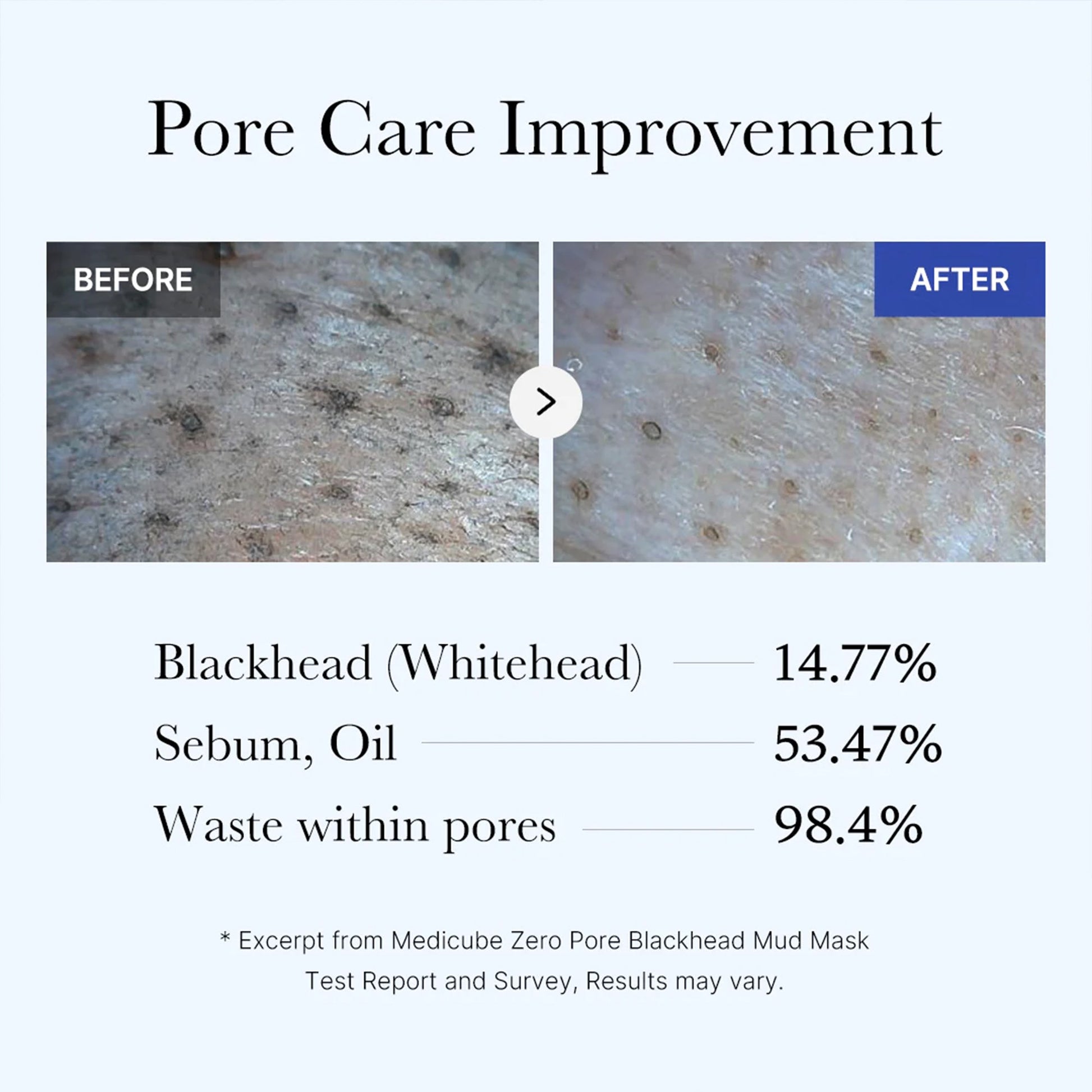 zero-pore-blackhead-mud-mask-n4 05_9362a158-c2b3-4525-acc0-631a2cfdea47.jpg