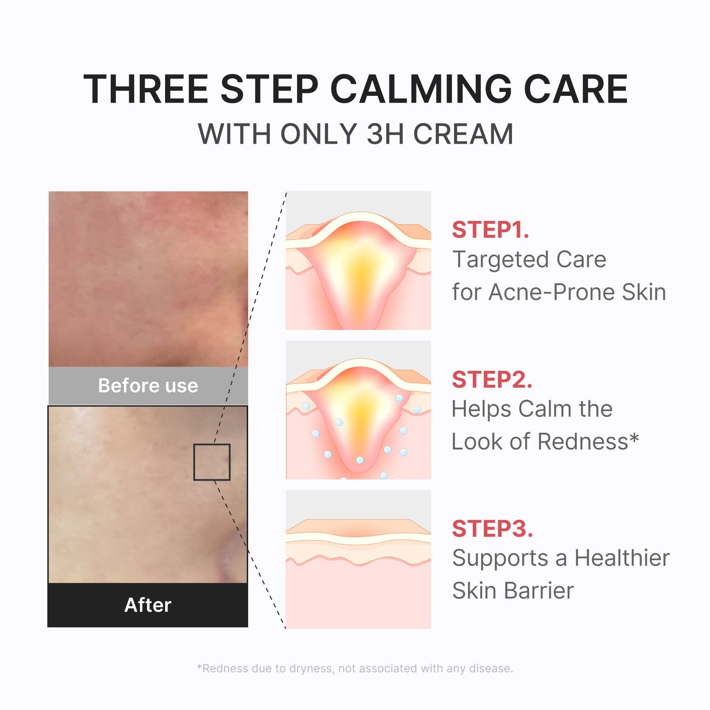 3h-daily-relief-cream-c8 3H_04.jpg