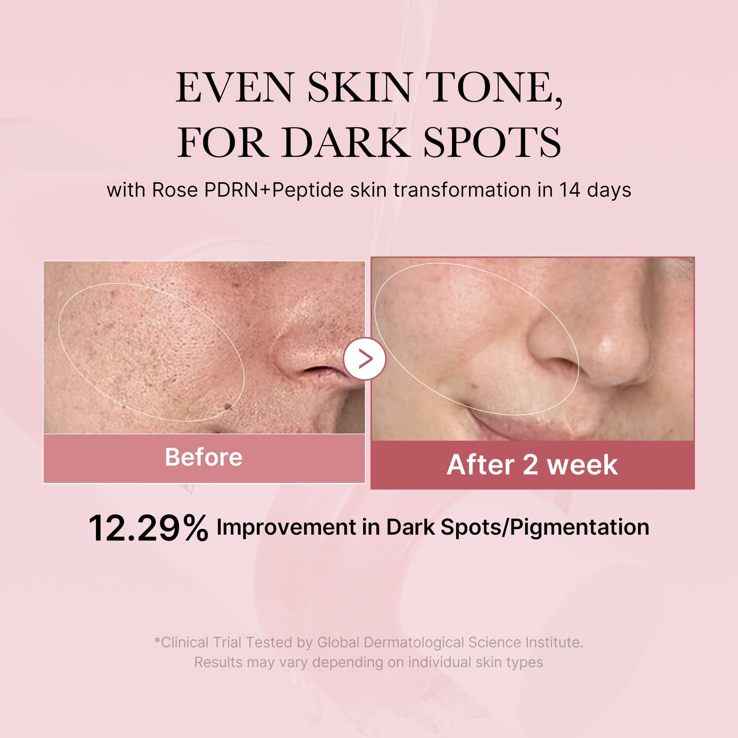 pdrn-pink-peptide-toner-p8 PDRN_01_308c518e-5ac6-4e54-99bd-eabc8796739b.jpg
