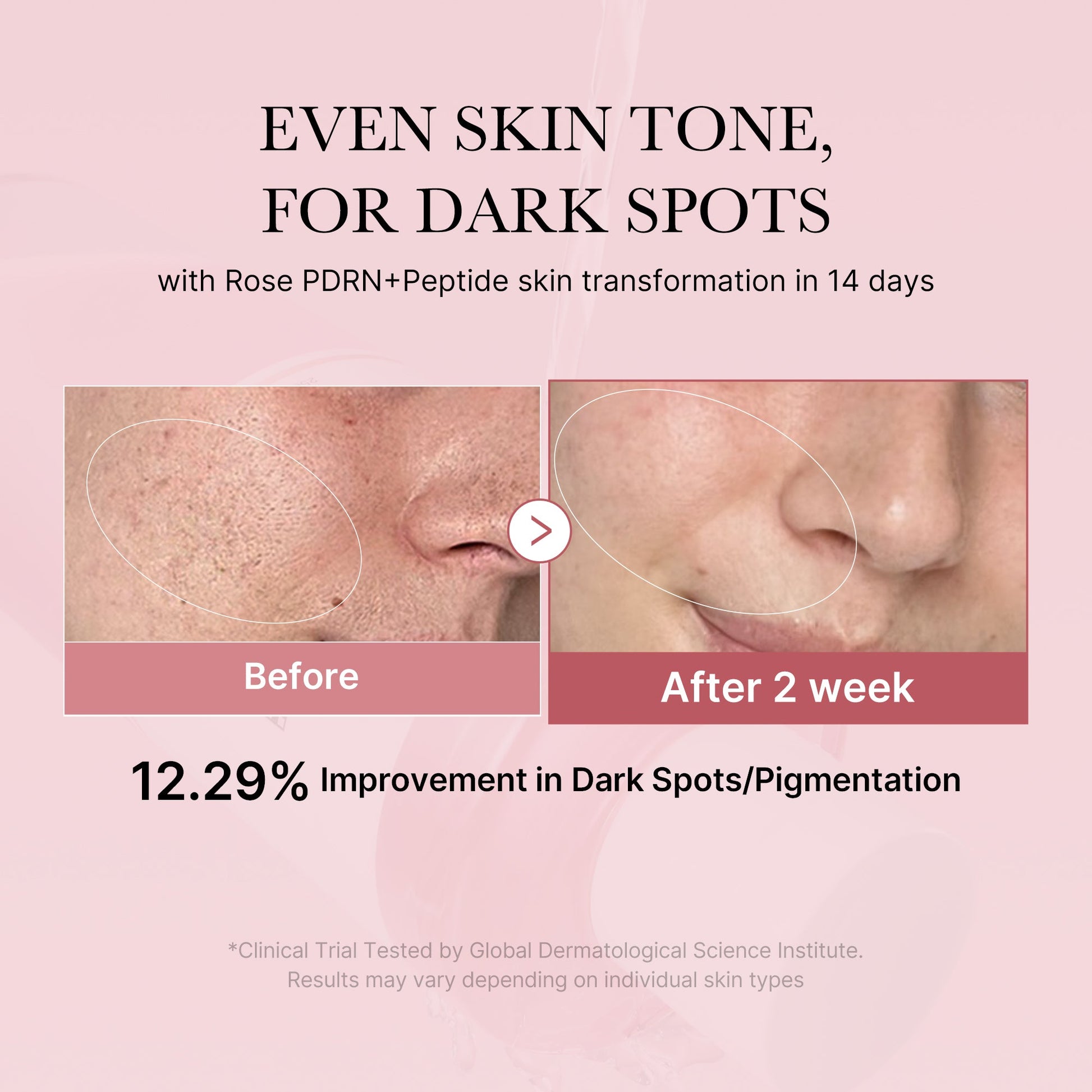 pdrn-pink-peptide-toner-p8 PDRN_01_308c518e-5ac6-4e54-99bd-eabc8796739b.jpg