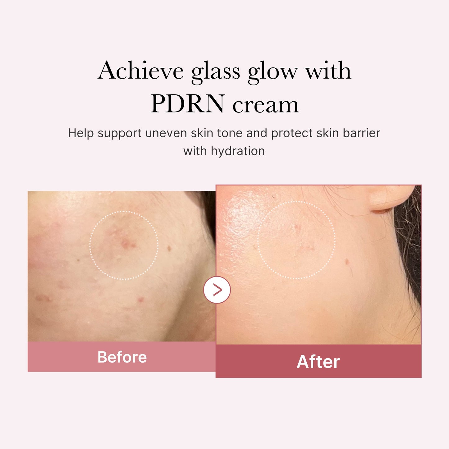 pdrn-pink-peptide-cream-p5 PDRN_02_d7805bfe-cf43-446a-b71b-a276683f136b.jpg