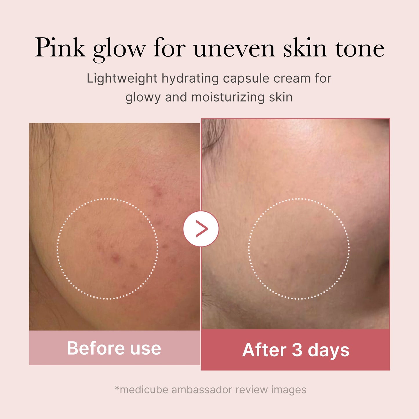 pdrn-pink-collagen-capsule-cream-q7 PDRN_03_058d09d8-4f44-4b1e-927c-e27b1738ae51.jpg