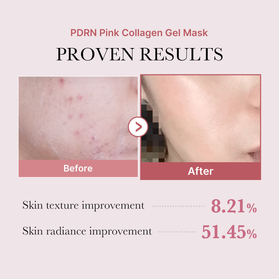 salmon-pdrn-pink-collagen-jelly-gel-mask-a1 PDRN_12.jpg